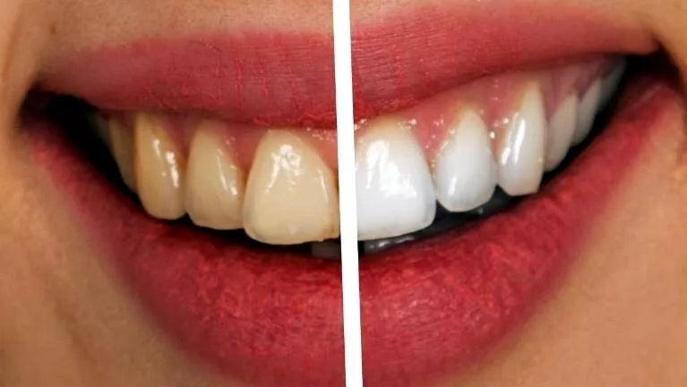 FLUORIDE FREE Natural Bamboo Charcoal Mint Toothpaste Teeth Whitening Oral Care